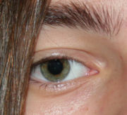 A green-brown human iris displaying a dark brown center and a green outer area. This type of iris, although rare, is often also called hazel.