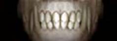 Dentes incisivos.jpg (6540 bytes)