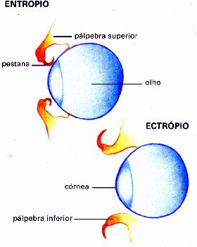 entropio.jpg (19056 bytes)