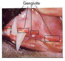 gengivite.jpg (15298 bytes)