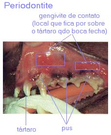 periodontite.jpg (11599 bytes)